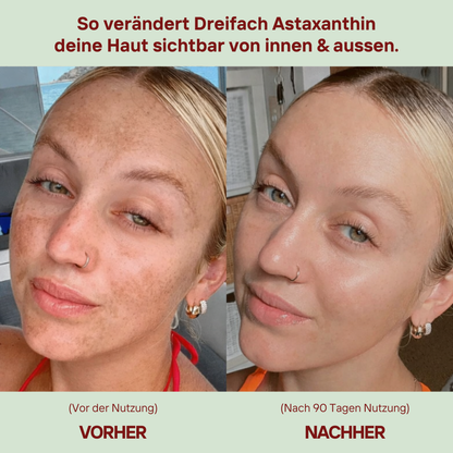 Alimora - Dreifach Astaxanthin